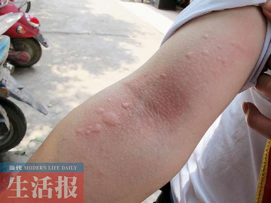 今年南宁市毛毛虫灾害来得猛 绿城打响绿树保卫战